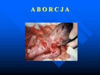 /album/fotogaleria-fotogaleria/slajd2-jpg/