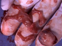 /album/okrucie%c5%84stwo%20aborcji/aborcja-01-jpg/