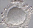 /album/fotogaleria-in-vitro/oocyt-jpg/